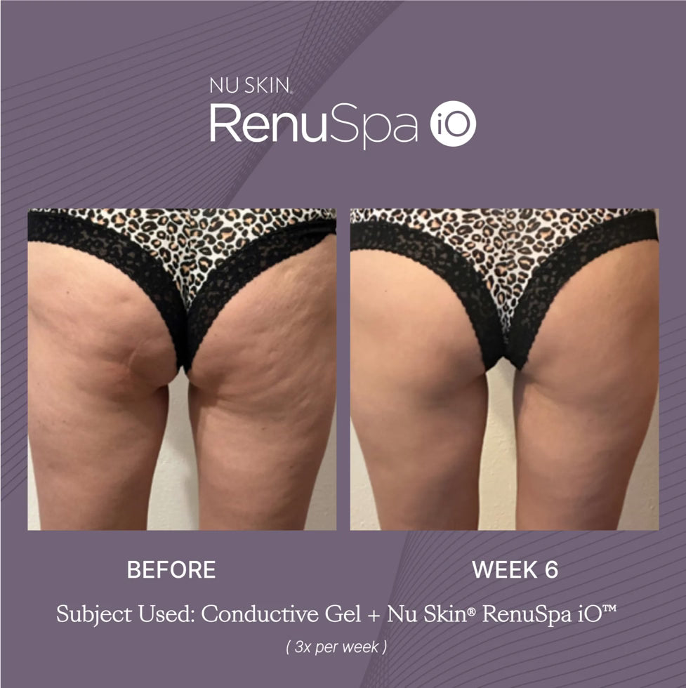 Nu Skin RenuSpa iO