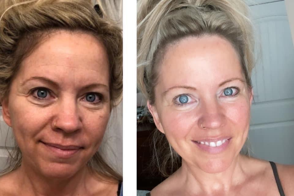 Nu Skin LumiSpa iO
