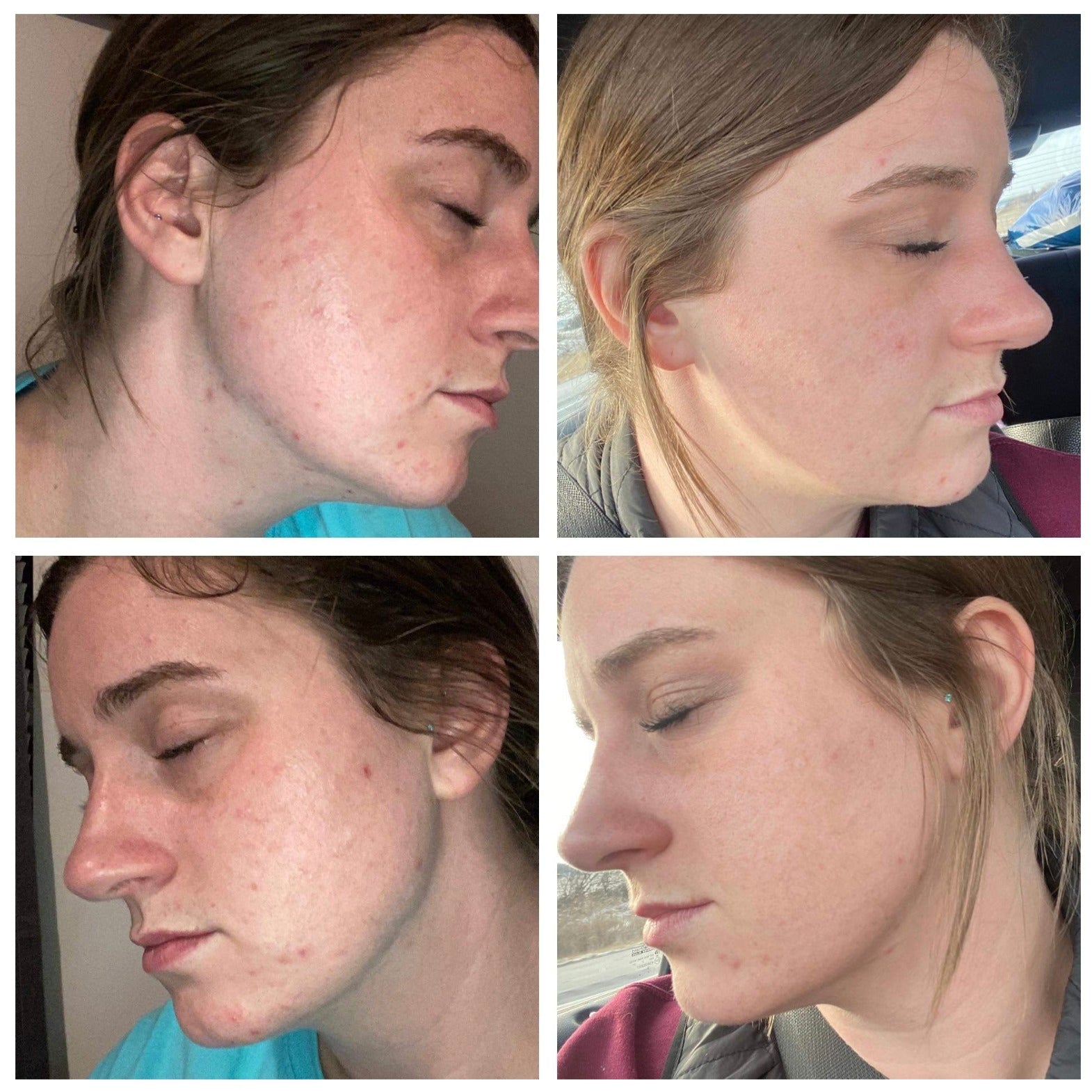 Nu Skin LumiSpa iO