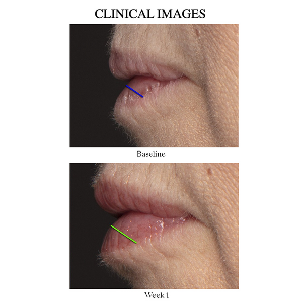 Nu Skin Peptide Pout
