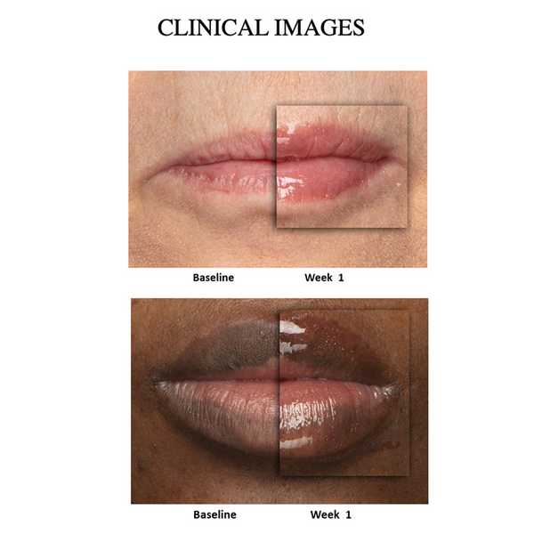 Nu Skin Peptide Pout
